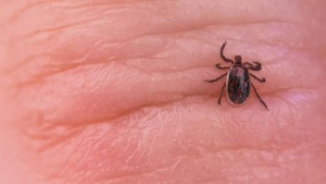 She was in peak shape, then a tick bite left her paralysed: What we need to keep in mind when going outdoors
