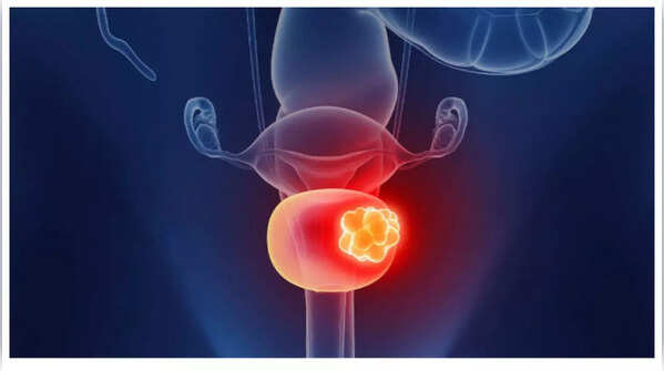 Person with lower back and pelvic pain